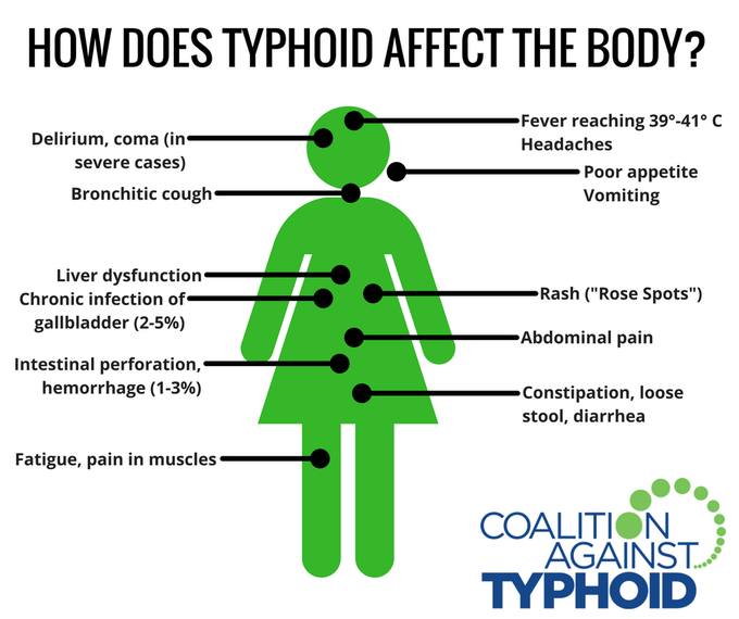 Typhoid