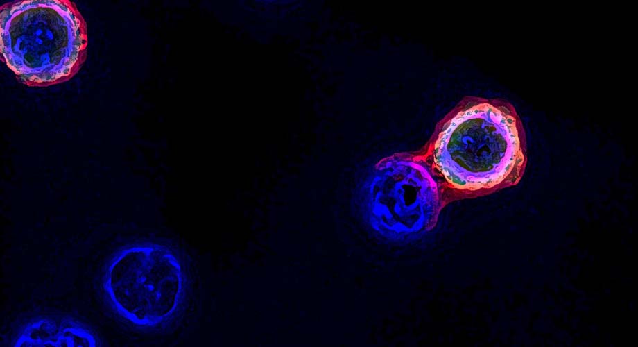 Rapid method of isolating tumor-targeting T cells