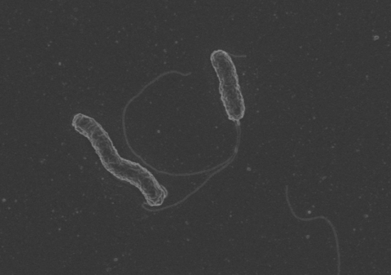 links between the C. concisus bacterium (pictured) and gut health for over a decade. Her team captured this photo of the bacterium via an electron microscope.