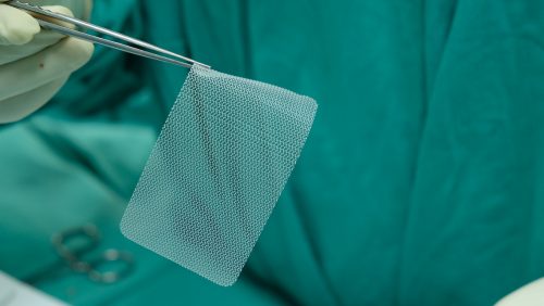 synthetic mesh hernia surgery