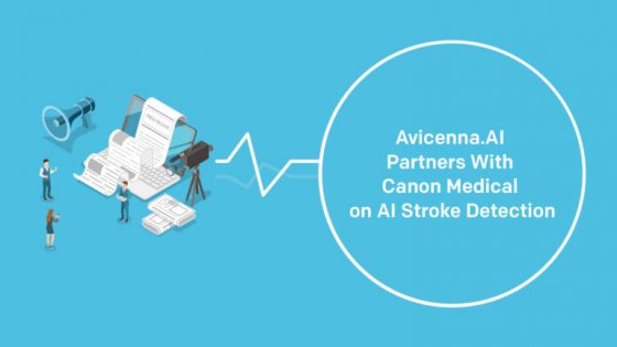 stroke detection AI solution